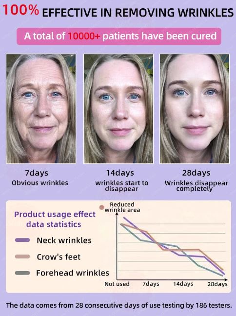 Anti Wrinkle Essence – Smooth, Youthful Skin Formula