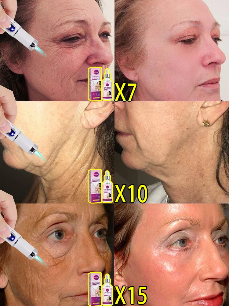 Facial Firming Elevator Korean Cosmetic