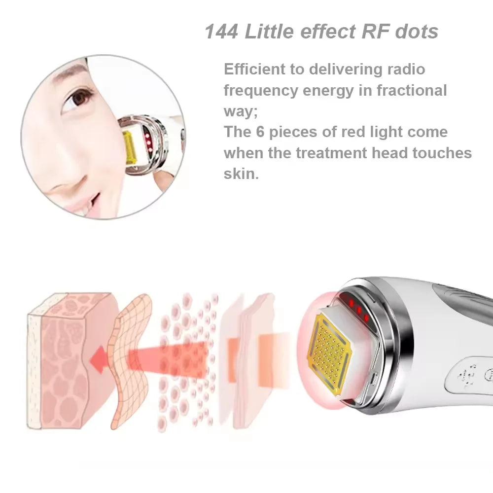 Radio Frequency Facial Lifting Machine delivering gentle RF energy for skin rejuvenation and lifting.