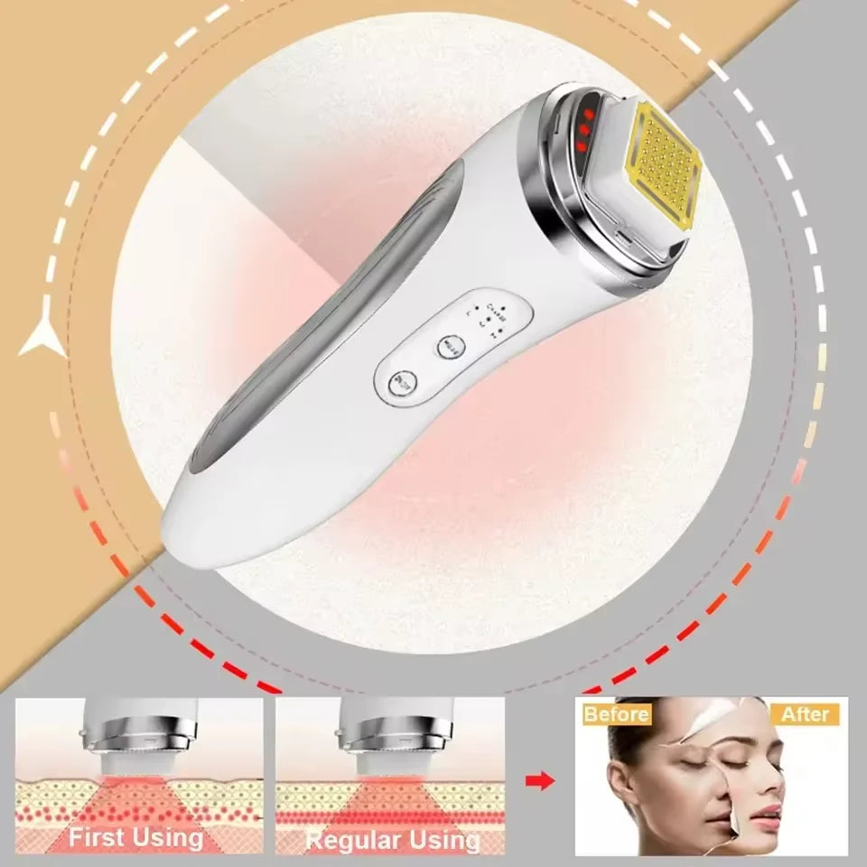Radio Frequency Facial Lifting Machine with LED display and skin rejuvenation features, showing before and after results.
