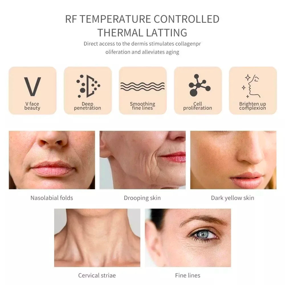 Radio Frequency Facial Lifting Machine